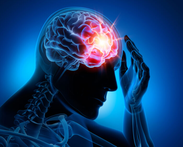Signs Your Neck Pain Could Be a Traumatic Brain Injury