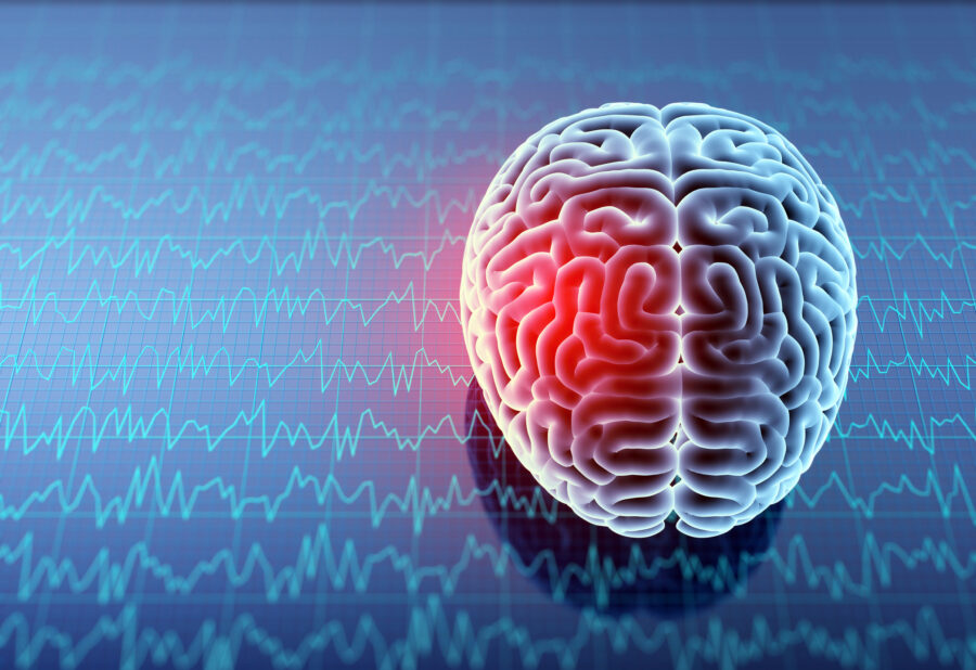 What Is a Traumatic Brain Injury?